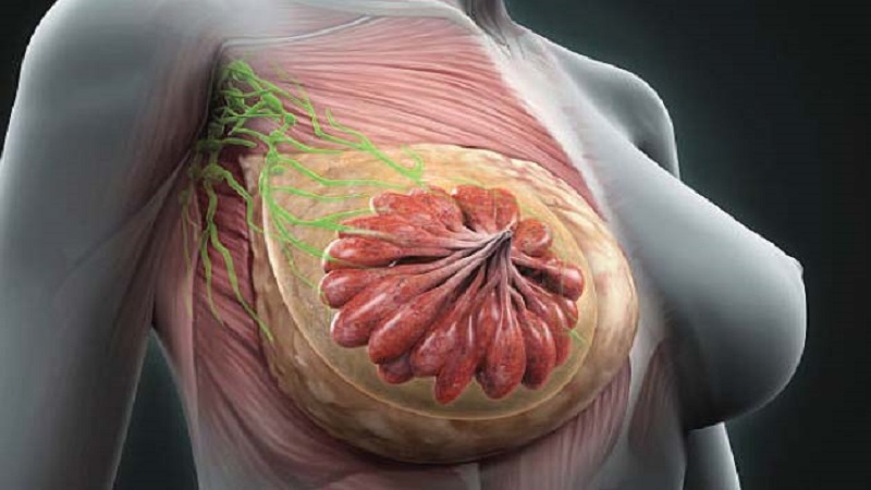 جراح پستان اصفهان | پروتز پستان اصفهان | پاپیلوما سینه و سرطان پستان .