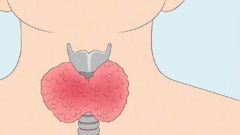 جراح پستان اصفهان | پروتز پستان اصفهان | اختلالات تیروئیدی