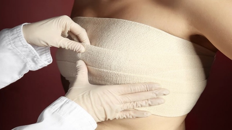 جراح پستان اصفهان | پروتز پستان اصفهان | دکتر رسول فاتحی فرد | چرا خانم‌ها دنبال جراحی لیفت سینه هستند؟