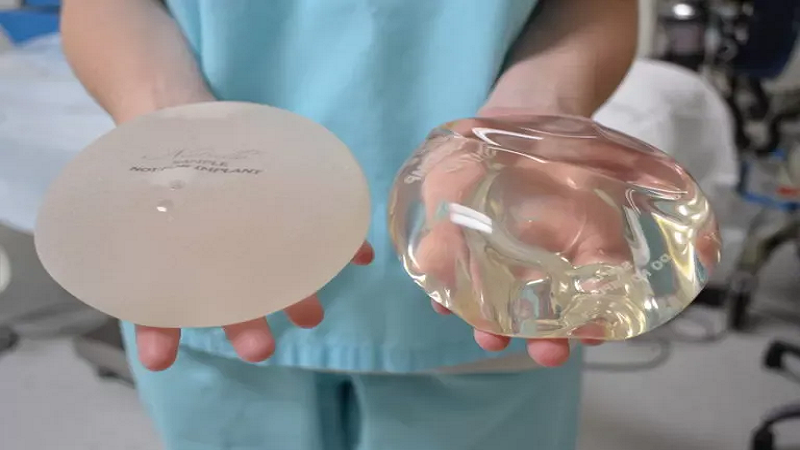 جراح پستان اصفهان | پروتز پستان اصفهان | دکتر رسول فاتحی فرد | سوالات متداول برای جراحی پروتز پستان