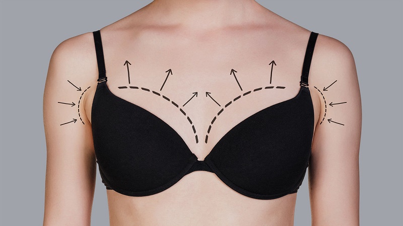 جراح پستان اصفهان | پروتز پستان اصفهان | دکتر رسول فاتحی فرد | هدف از جراحی بازسازی سینه